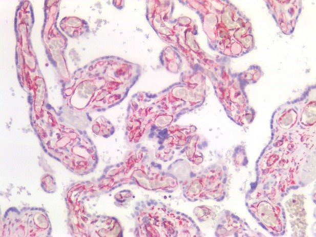 Figure 4. Immunostaining of human paraffin embedded tissue section of placenta with MUB1904P (diluted 1:200), showing the specific pattern of vimentin in the mesenchymal cell types, such as fibroblasts in the connective tissue, and endothelial cells in blood vessels. As expected, no reactivity is seen in the epithelial cell compartment.